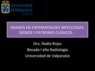 IMAGEN EN ENFERMEDADES INFECCIOSAS:
SIGNOS Y PATRONES CLÁSICOS.
IMAGEN EN ENFERMEDADES INFECCIOSAS:
SIGNOS Y PATRONES CLÁSICOS.
Dra. Nadia Rojas
Becada I año Radiología
Universidad de Valparaíso
 