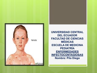UNIVERSIDAD CENTRAL 
DEL ECUADOR 
FACULTAD DE CIENCIAS 
MÉDICAS 
ESCUELA DE MEDICINA 
PEDIATRÍA 
ENFERMEDADES 
INFECTOCONTAGIOSAS 
Nombre: Pila Diego 
 