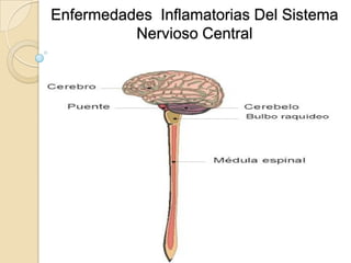 Enfermedades Inflamatorias Del Sistema
          Nervioso Central
 