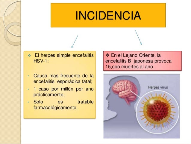 Enfermedades inflamatorias del sistema nervioso central