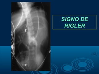 Enfermedades inflamatorias intestinales | PPT