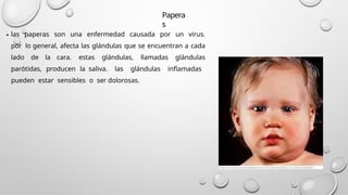 Paperas Inflamadas ENFERMEDADES INMUNOPREVENIBLES GRUPO 4 - ASISTENCIA EN INMUNIZACIÓN.pptx