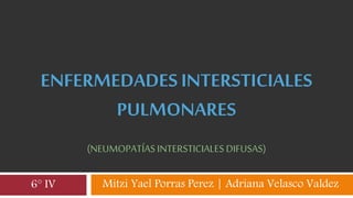 ENFERMEDADESINTERSTICIALES
PULMONARES
(NEUMOPATÍAS INTERSTICIALES DIFUSAS)
Mitzi Yael Porras Perez | Adriana Velasco Valdez6° IV
 