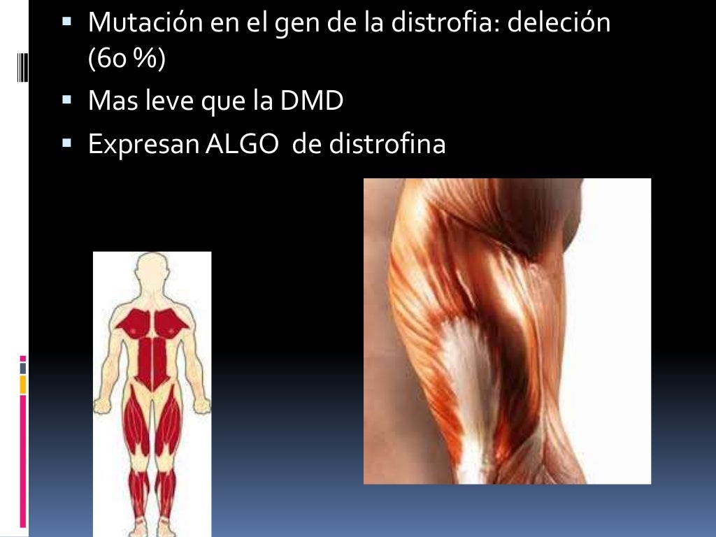 Enfermedades ligadas a Cromosoma X