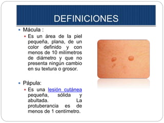  Mácula :
 Es un área de la piel
pequeña, plana, de un
color definido y con
menos de 10 milímetros
de diámetro y que no
presenta ningún cambio
en su textura o grosor.
 Pápula:
 Es una lesión cutánea
pequeña, sólida y
abultada. La
protuberancia es de
menos de 1 centímetro.
 