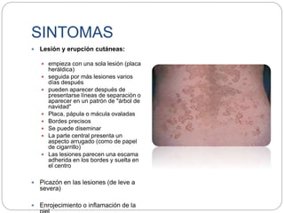 SINTOMAS
 Lesión y erupción cutáneas:
 empieza con una sola lesión (placa
heráldica)
 seguida por más lesiones varios
días después
 pueden aparecer después de
presentarse líneas de separación o
aparecer en un patrón de "árbol de
navidad"
 Placa, pápula o mácula ovaladas
 Bordes precisos
 Se puede diseminar
 La parte central presenta un
aspecto arrugado (como de papel
de cigarrillo)
 Las lesiones parecen una escama
adherida en los bordes y suelta en
el centro
 Picazón en las lesiones (de leve a
severa)
 Enrojecimiento o inflamación de la
 