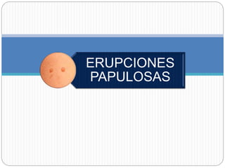 ERUPCIONES
PAPULOSAS
 