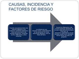 CAUSAS, INCIDENCIA Y
FACTORES DE RIESGO
Cuando una persona tiene una
reacción alérgica a una
sustancia, se liberan histamina y
otros químicos dentro del
torrente sanguíneo, causando
prurito, inflamación y otros
síntomas.
La urticaria es una
reacción común, especialmente
en las personas con otras
reacciones alérgicas, como la
fiebre de heno.
Cuando la inflamación o las
ronchas aparecen alrededor de
la cara, especialmente los labios
y los ojos, se
denomina angioedema, el cual
también puede ocurrir alrededor
de las manos, los pies y la
garganta.
 