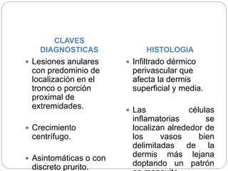 CLAVES
DIAGNOSTICAS HISTOLOGIA
 Lesiones anulares
con predominio de
localización en el
tronco o porción
proximal de
extremidades.
 Crecimiento
centrífugo.
 Asintomáticas o con
discreto prurito.
 Infiltrado dérmico
perivascular que
afecta la dermis
superficial y media.
 Las células
inflamatorias se
localizan alrededor de
los vasos bien
delimitadas de la
dermis más lejana
doptando un patrón
 