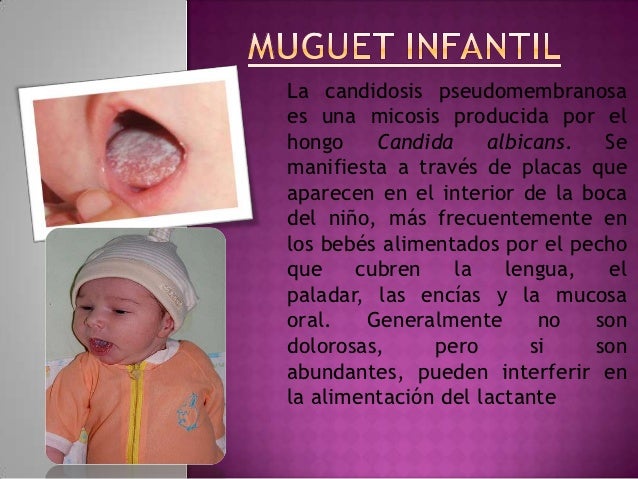Enfermedades Mas Comunes De Los Ninos Con La Letra M Y N