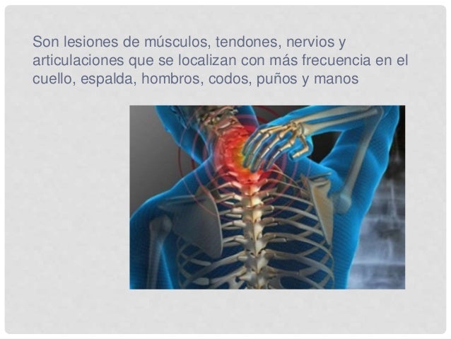 Enfermedades mas comunes del sistema musculo esqueletico