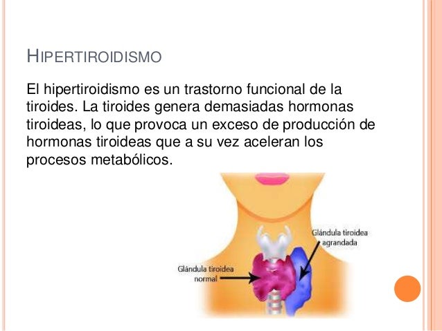 Dieta cetogénica en la forma natural