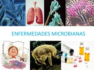 ENFERMEDADES MICROBIANAS
 