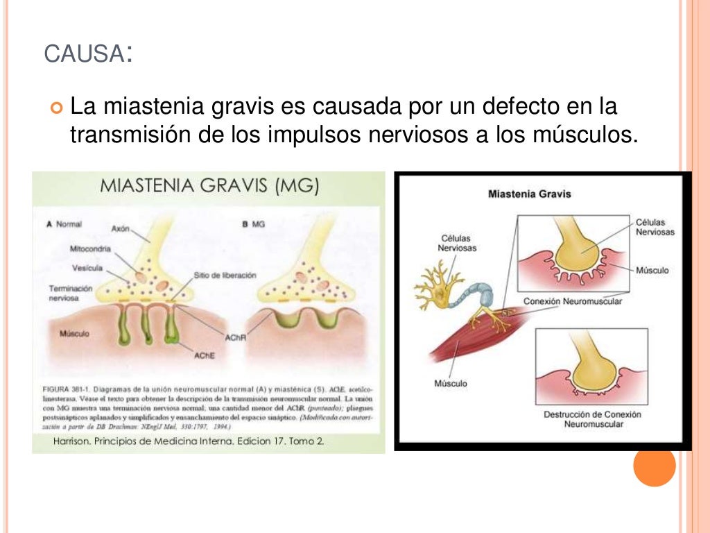 Enfermedades musculares ppt