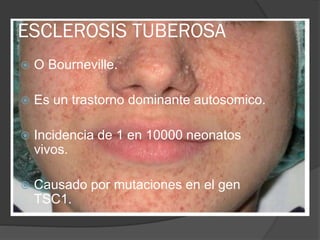 ESCLEROSIS TUBEROSA
 O Bourneville.
 Es un trastorno dominante autosomico.
 Incidencia de 1 en 10000 neonatos
vivos.
 Causado por mutaciones en el gen
TSC1.
 