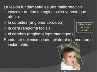 La lesion fundamental es una malformacion
vascular de tipo telangiectasico-venoso que
afecta:
 la coroides (angioma coroideo)
 la cara (angioma facial)
 el cerebro (angioma leptomeningeo)
Puede ser del mismo lado, bilateral o presentarse
inclompleto.
Mancha en
vino de
oporto
 