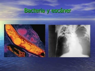 Bacteria y escáner 