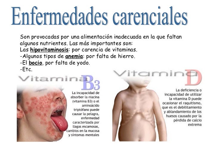 enfermedades de las prostitutas prostitutas para niños enfermedades de las prostitutas prostitutas para niños
