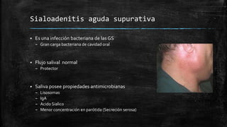 Sialoadenitis aguda supurativa
 Es una infección bacteriana de las GS
– Gran carga bacteriana de cavidad oral
 Flujo sal...