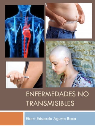 ENFERMEDADES NO
TRANSMISIBLES
Ebert Eduardo Agurto Baca
 