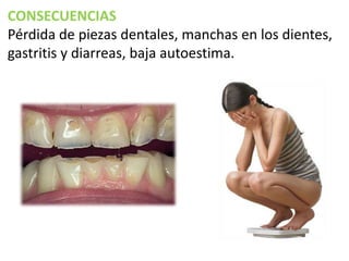 CONSECUENCIAS
Pérdida de piezas dentales, manchas en los dientes,
gastritis y diarreas, baja autoestima.

 