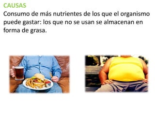 CAUSAS
Consumo de más nutrientes de los que el organismo
puede gastar: los que no se usan se almacenan en
forma de grasa.

 