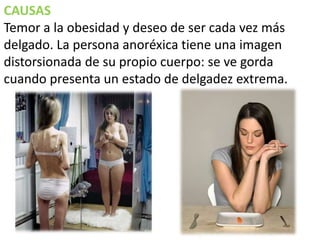 CAUSAS
Temor a la obesidad y deseo de ser cada vez más
delgado. La persona anoréxica tiene una imagen
distorsionada de su propio cuerpo: se ve gorda
cuando presenta un estado de delgadez extrema.

 