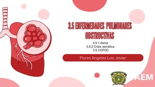 Flores Ángeles Luis Javier
3.5.1 Asma.
3.5.2 Crisis asmática.
3.5.3 EPOC
 