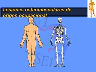 Lesiones osteomusculares deLesiones osteomusculares de
origen ocupacionalorigen ocupacional
 