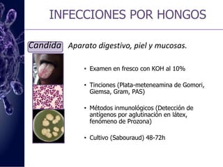 INFECCIONES POR BACTERIASTreponema pallidumELISAWestern Blot (Anticuerpo)	para epítopes de Ag)PCR. Amplifica varias veces secuencias específicas de ADN