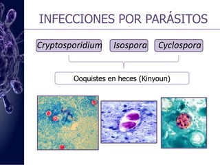 INFECCIONES POR PARÁSITOS  Toxoplasma gondiiLCR, sangre, LBAEncefalitis. Biopsia cerebral:  Tinción con inmunoperoxidasa, H-E. Hallazgo de taquizoitos.Tinción. LCR (Wright-Giemsa)Cultivo. Sangre, LCRPCRNeumonía.Visualización del parásito (Tinción Giemsa) o cultivo celular a partir de LBA o esputo inducido