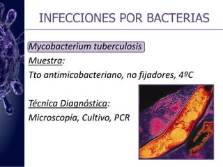 INFECCIONES POR BACTERIASMycobacterium tuberculosis Muestra:Ttoantimicobacteriano, no fijadores, 4ºCTécnica Diagnóstica:Microscopía, Cultivo, PCR 
