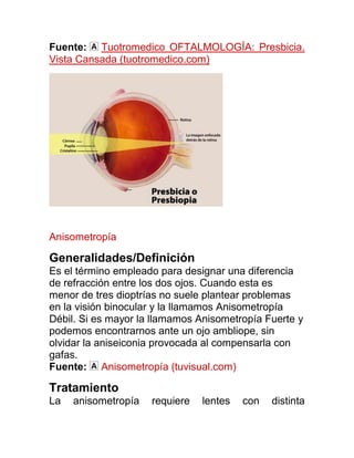 Fuente: Tuotromedico OFTALMOLOGÍA: Presbicia.
Vista Cansada (tuotromedico.com)




Anisometropía

Generalidades/Definición
Es el término empleado para designar una diferencia
de refracción entre los dos ojos. Cuando esta es
menor de tres dioptrías no suele plantear problemas
en la visión binocular y la llamamos Anisometropía
Débil. Si es mayor la llamamos Anisometropía Fuerte y
podemos encontrarnos ante un ojo ambliope, sin
olvidar la aniseiconia provocada al compensarla con
gafas.
Fuente: Anisometropía (tuvisual.com)

Tratamiento
La   anisometropía   requiere   lentes   con   distinta
 