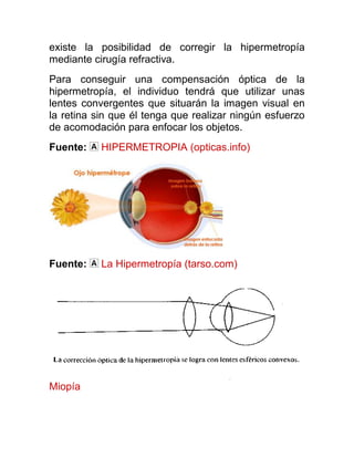 existe la posibilidad de corregir la hipermetropía
mediante cirugía refractiva.
Para conseguir una compensación óptica de la
hipermetropía, el individuo tendrá que utilizar unas
lentes convergentes que situarán la imagen visual en
la retina sin que él tenga que realizar ningún esfuerzo
de acomodación para enfocar los objetos.
Fuente:    HIPERMETROPIA (opticas.info)




Fuente:    La Hipermetropía (tarso.com)




Miopía
 