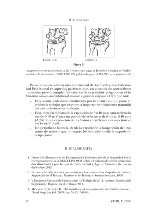 M. A. Daniel Calvo
62	 CFOR, 11/2014
Pensaremos en calificar una enfermedad de Kienböck como Enferme-
dad Profesional en aquellos pacientes que, en ausencia de antecedente
traumático previo, cumplen los criterios de exposición recogidos en el In-
formation notices on occupational diseases: a guide to diagnosis (17) y que son:
-	 Exposición profesional confirmada por la anamnesis que pone en
evidencia trabajos que exponen a importantes vibraciones transmiti-
das por máquinas-herramientas.
-	 Una duración mínima de la exposición de 3 a 10 años para aceleracio-
nes de 3-10 m/s2
para un periodo de referencia de 8 horas, 3-10 m/s2
(A(8)), y una exposición de 1 a 3 años en aceleraciones superiores a
los 10 m/s2
(A(8)).
-	 Un periodo de latencia, desde la exposición a la aparición del tras-
torno de meses y que no supere los dos años desde la exposición
ocupacional.
II. BIBLIOGRAFÍA
	 1.	 Datos del Observatorio de Enfermedades Profesionales de la Seguridad Social
correspondientes a la tabla CEPROSS-2. sobre el número de partes comunica-
dos distribuidos por Grupo de Enfermedad y Agente Causante de enero-
diciembre 2012.
	2.	Bovenzi M. Vibraciones transmitidas a las manos. Enciclopedia de Salud y
Seguridad en el Trabajo. Ministerio de Trabajo y Asuntos Sociales, 1998.
	 3.	 V Encuesta Nacional de Condiciones de Trabajo de 2011, Instituto Nacional de
Seguridad e Higiene en el Trabajo, 2012.
	4.	Mennen U, Sithebe H. The incidence of asymptomatic Kienböck’s disease. J
Hand Surg Eur Vol. 2009 Jun; 34 (3): 348-50.
Estadio III-b Estadio IV
Imágenes correspondientes a las Directrices para la Decisión Clínica en Enfer­
medades Profesionales (DDC-TME-03) publicadas por el INSHT en su página web.
Figura 5
03. Daniel Calvo.indd 62 14/04/15 10:42
 