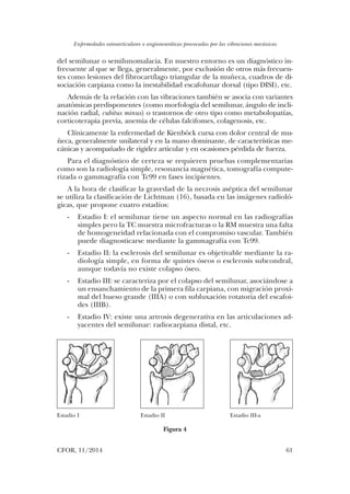 Enfermedades osteoarticulares o angioneuróticas provocadas por las vibraciones mecánicas
CFOR, 11/2014	 61
del semilunar o semilunomalacia. En nuestro entorno es un diagnóstico in-
frecuente al que se llega, generalmente, por exclusión de otros más frecuen-
tes como lesiones del fibrocartílago triangular de la muñeca, cuadros de di-
sociación carpiana como la inestabilidad escafolunar dorsal (tipo DISI), etc.
Además de la relación con las vibraciones también se asocia con variantes
anatómicas predisponentes (como morfología del semilunar, ángulo de incli-
nación radial, cubitus minus) o trastornos de otro tipo como metabolopatías,
corticoterapia previa, anemia de células falcifomes, colagenosis, etc.
Clínicamente la enfermedad de Kienböck cursa con dolor central de mu-
ñeca, generalmente unilateral y en la mano dominante, de características me-
cánicas y acompañado de rigidez articular y en ocasiones pérdida de fuerza.
Para el diagnóstico de certeza se requieren pruebas complementarias
como son la radiología simple, resonancia magnética, tomografía compute-
rizada o gammagrafía con Tc99 en fases incipientes.
A la hora de clasificar la gravedad de la necrosis aséptica del semilunar
se utiliza la clasificación de Lichtman (16), basada en las imágenes radioló-
gicas, que propone cuatro estadíos:
-	 Estadio I: el semilunar tiene un aspecto normal en las radiografías
simples pero la TC muestra microfracturas o la RM muestra una falta
de homogeneidad relacionada con el compromiso vascular. También
puede diagnosticarse mediante la gammagrafía con Tc99.
-	 Estadio II: la esclerosis del semilunar es objetivable mediante la ra-
diología simple, en forma de quistes óseos o esclerosis subcondral,
aunque todavía no existe colapso óseo.
-	 Estadio III: se caracteriza por el colapso del semilunar, asociándose a
un ensanchamiento de la primera fila carpiana, con migración proxi-
mal del hueso grande (IIIA) o con subluxación rotatoria del escafoi-
des (IIIB).
-	 Estadio IV: existe una artrosis degenerativa en las articulaciones ad-
yacentes del semilunar: radiocarpiana distal, etc.
Estadio I Estadio II Estadio III-a
Figura 4
03. Daniel Calvo.indd 61 14/04/15 10:42
 
