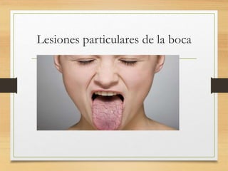 Lesiones particulares de la boca
 