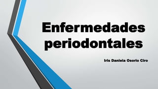 Enfermedades 
periodontales 
Iris Daniela Osorio Ciro 
 