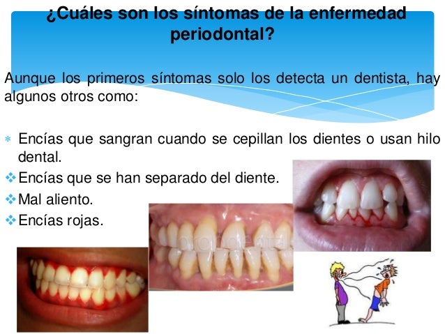 Cules Son Los Primeros Sntomas Del Reumatismo Cules Son Los Primeros Sntomas Del Reumatismo