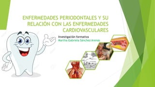 ENFERMEDADES PERIODONTALES Y SU
RELACIÓN CON LAS ENFERMEDADES
CARDIOVASCULARES
Investigación formativa
Martha Gabriela Sánchez Arenas
 