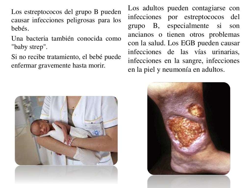 Enfermedades por estreptococos grupo b
