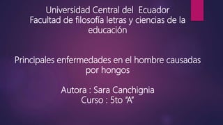 Universidad Central del Ecuador
Facultad de filosofía letras y ciencias de la
educación
Principales enfermedades en el hombre causadas
por hongos
Autora : Sara Canchignia
Curso : 5to “A”
 