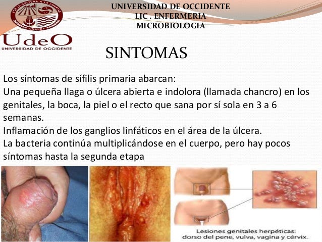 Como librarse de la osteocondrosis la gimnasia