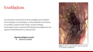Enfermedades producidas por hongos | PDF