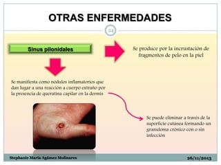 OTRAS ENFERMEDADES
24

Sinus pilonidales

Se produce por la incrustación de
fragmentos de pelo en la piel

Se manifiesta como nódulos inflamatorios que
dan lugar a una reacción a cuerpo extraño por
la presencia de queratina capilar en la dermis

Se puede eliminar a través de la
superficie cutánea formando un
granuloma crónico con o sin
infección

Stephanie María Agámez Molinares

26/11/2013

 