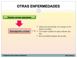 OTRAS ENFERMEDADES
25

Estrato corneo esponjoso

Espongiosis cornea

Stephanie Maria Agámez Molinares

 Alteración presentada con arrugas en los
dedos con dolor.
 Con mayor rapidez en agua caliente que
fría.
 Son reversibles después del secado.

26/11/2013

 