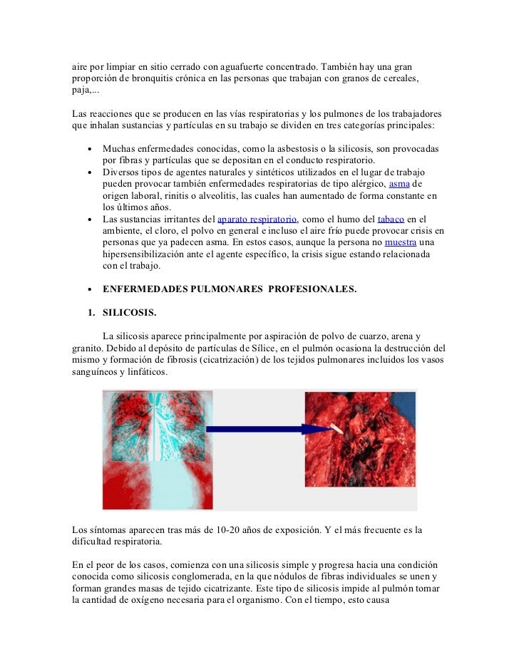 El acné de los recién nacidos los síntomas