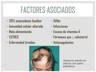 FACTORES ASOCIADOS
• 20% antecedente familiar
• Inmunidad celular alterada
• Mala alimentación
• ESTRES
• Enfermedad tiroidea

• Sífilis
• Infecciosas
• Exceso de vitamina A
• Fármacos que ↓ colesterol
• Anticoagulantes

Alopecia areata en
placas con pelos
peládicos

 
