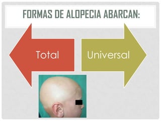 FORMAS DE ALOPECIA ABARCAN:

Total

Universal

 