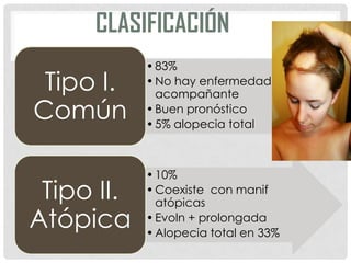CLASIFICACIÓN
Tipo I.
Común
Tipo II.
Atópica

• 83%
• No hay enfermedad
acompañante
• Buen pronóstico
• 5% alopecia total

• 10%
• Coexiste con manif
atópicas
• Evoln + prolongada
• Alopecia total en 33%

 